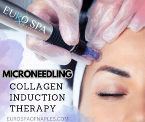 The Secret to Beautiful Skin: Microneedling Facial Treatments at Eurospa of Naples