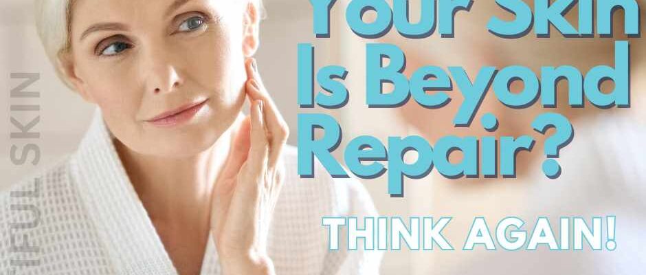 Think Your Skin is Beyond Repair? Think Again