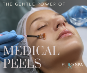 Naples Med spa - The gentle power of medical grade facial peels Eurospa of naples