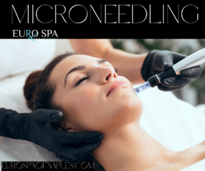 Microneedling Eurospa of Naples