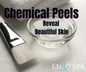 Chemical Peels 101: What to Expect and How They Transform Your Skin