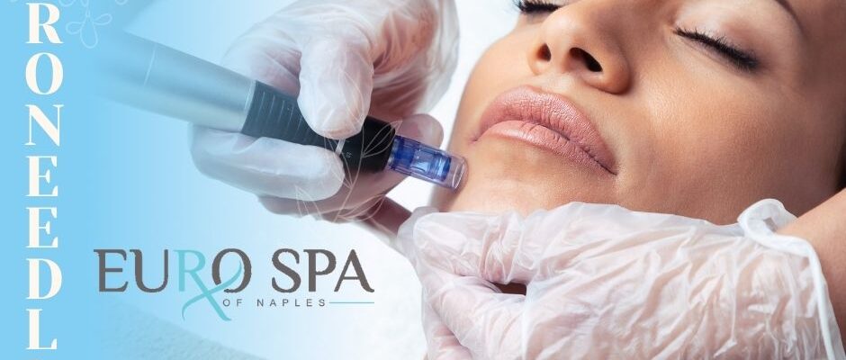 Eurospa of Naples, Microneedling services