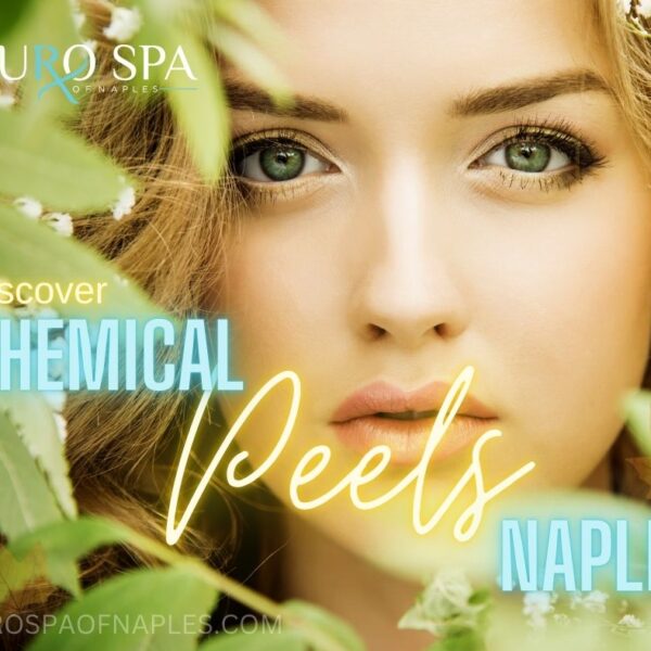 Discover the Perfect Chemical Peel for Your Skin Type in Naples