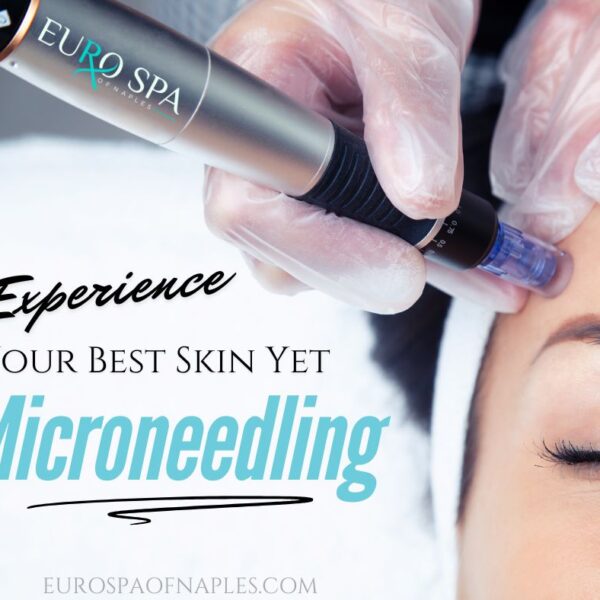 5 Ways Microneedling Can Transform Your Skin in Naples