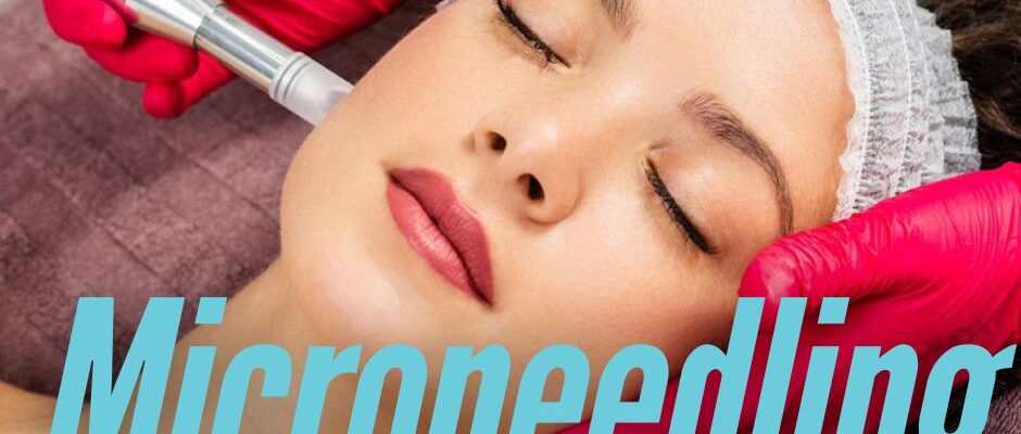 Microneedling Naples FLorida best Med Spa